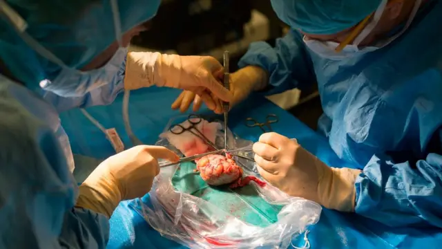 Пересадка почки