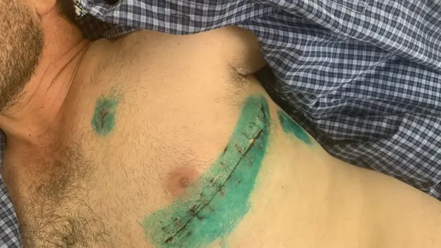 Füzuli Qarayev həyat yoldaşı Sevinc Məhərrəmovanı qorumağa çalışan iki qonşusuna xəsarət yetirib.