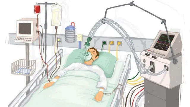 కరోనావైరస్:నెలకు 3 వేల వెంటిలేటర్ల తయారీకి ఏపీ ప్రభుత్వం ఏర్పాట్లు