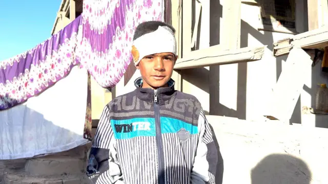 مجیب ۱۰ ساله که در حمله هوایی پاکستان به پلچرخی کابل زخمی شده است در مقابل خانه ویرانهٔشان ایستاده و به کمره نگاه میکند. ۱۳ مارچ ۲۰۲۶