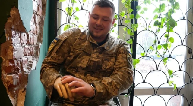 Pavlo Bahmut'ta kaybettiği kolunu gösteriyor.