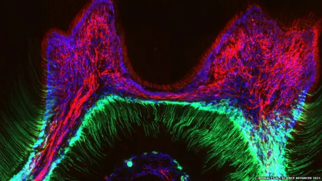 ਦੰਦ ਦਾ ਸਕੈਨ