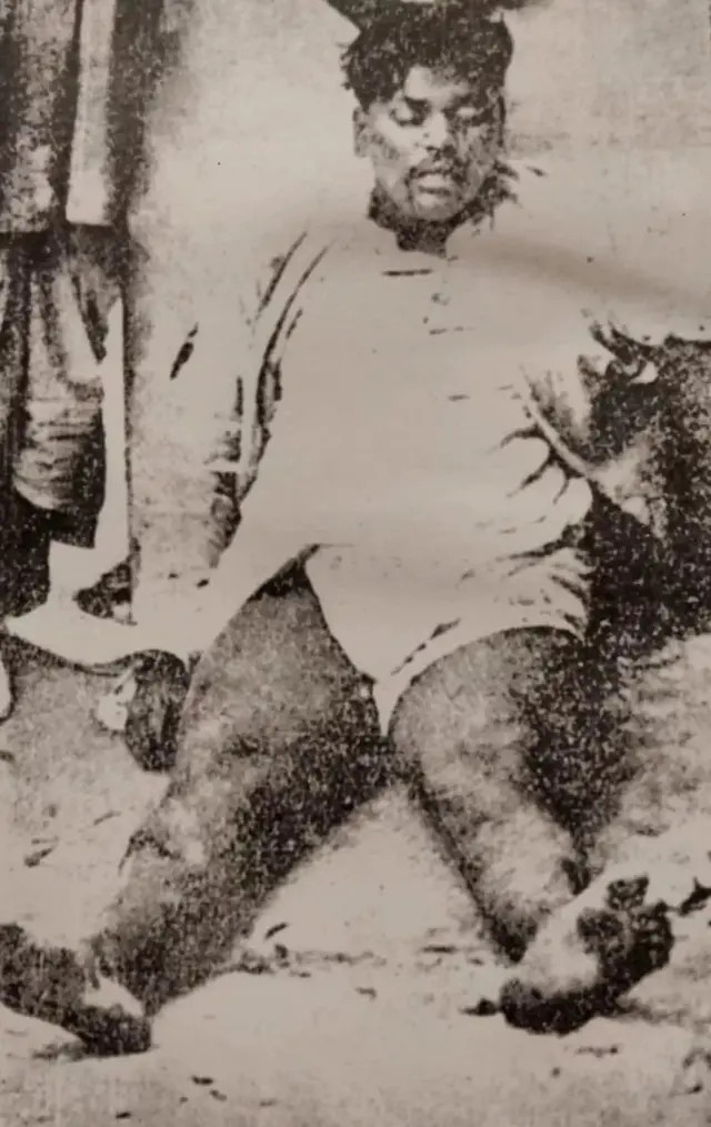 आज़ाद के शरीर का पोस्टमार्टम सिविल सर्जन लेफ़्टिनेंट कर्नल टाउनसेंड ने किया था