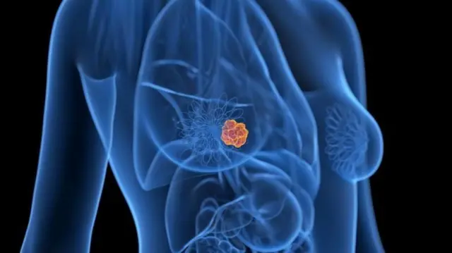 સ્કેનિંગ રિપોર્ટમાં જોવા મળેલી ગાંઠની તપાસ કરનાર ડોક્ટરને શંકા હતી. તેમણે કહ્યું કે તેની વધુ બારીક તપાસ કરવાની જરૂર છે