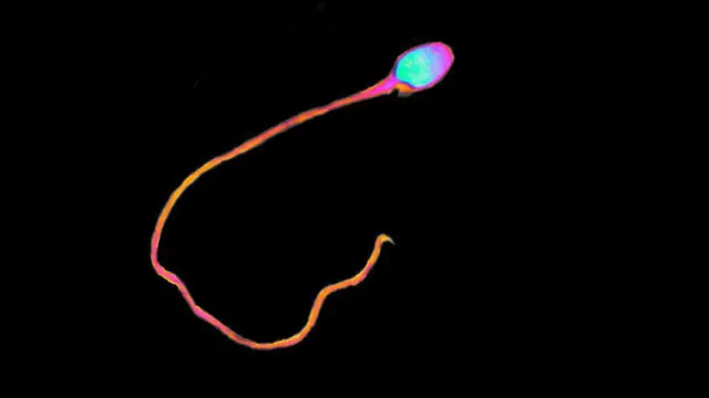 ਸ਼ਿਕਰਾਣੂ