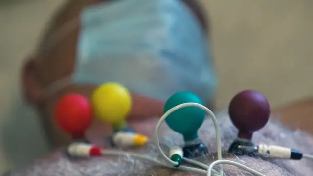 కోవిడ్-19