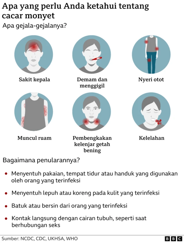 cacar monyet, kesehatan