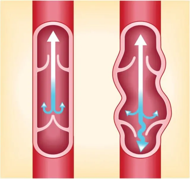 બીબીસી ગુજરાતી, ગુજરાત, બીબીસી, અમદાવાદ, હેલ્થ, સ્વાસ્થ્ય, 