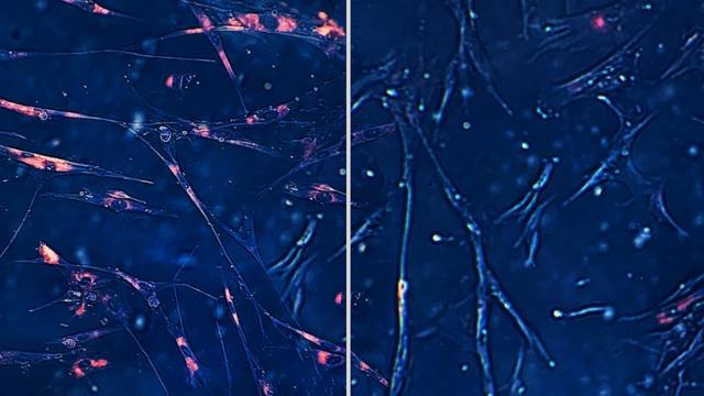 Colagemloterias lotofacil independencia2 imagens microscópicas