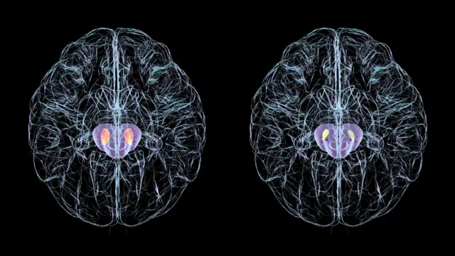 બીબીસી ગુજરાતી, ગુજરાત, બીબીસી, અમદાવાદ, બ્રેઇન, મગજ, યાદશક્તિ