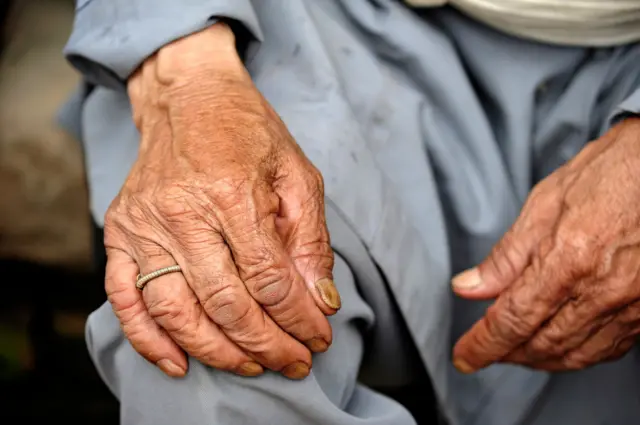 एक वृद्ध पुरुषको हात