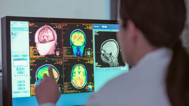 ਐੱਮਆਰਆਈ ਸਕੈਨਰ