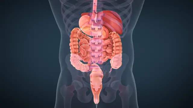 ఇరిటబుల్ బవెల్ సిండ్రోమ్