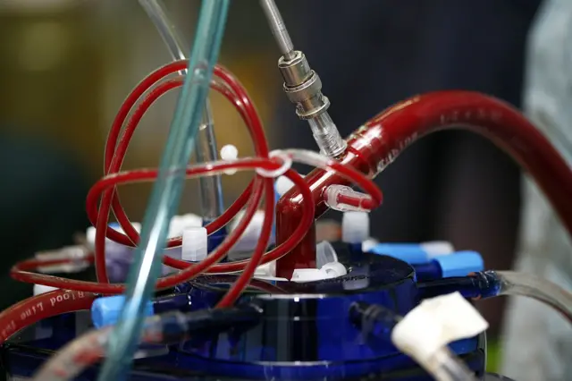 हार्ट-लङ मशीन