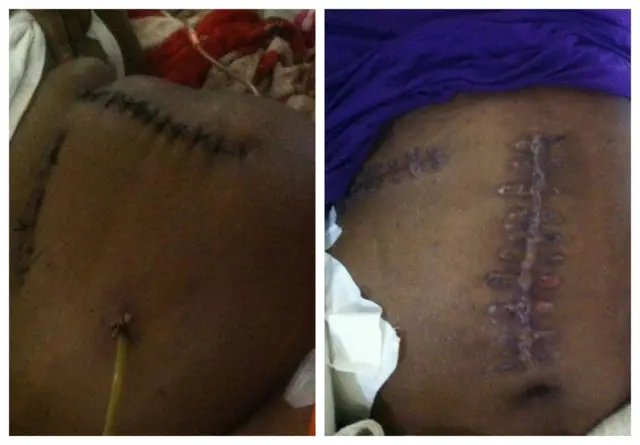 መአዛ ከጥቃቱ በኋላ ሆስፒታል ሳለች የተነሳ ፎቶ