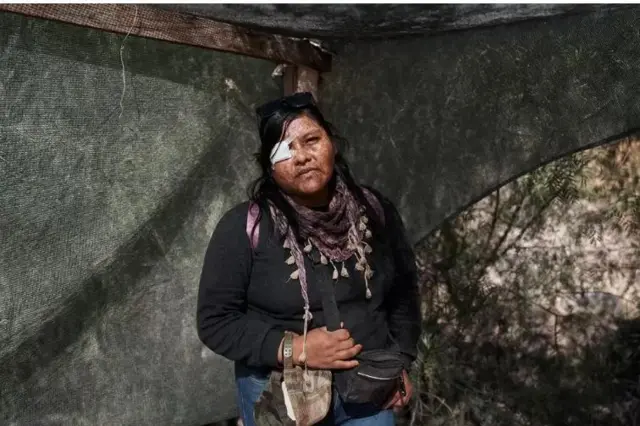 प्रदर्शनकारियों को हटाने के लिए पुलिस ने रबर की गोलियां चलाईं जिसमें एल्वा वैलेरियो की आंख में चोट लगी.