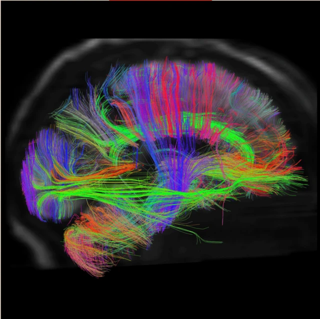 cerebro