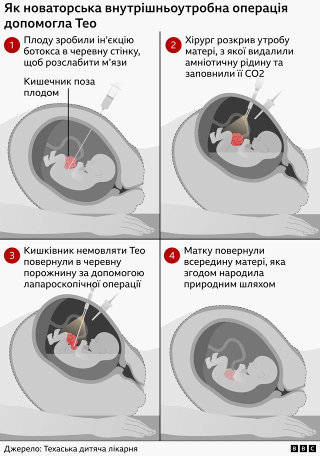 Графіка, як робили операцію Тео