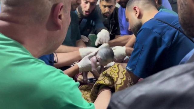 Bebé sacado del vientre de su madre muerta tras un ataque en Gaza.