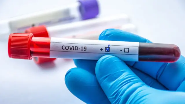 Prueba de sangre en un tubo de ensayo que dice covid-19.