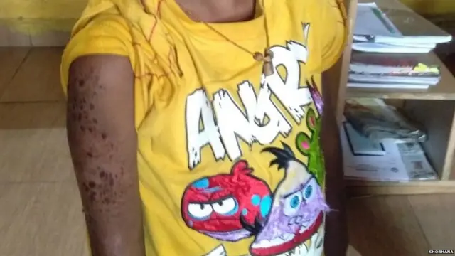 बच्चे, गोरापन, क्राइम