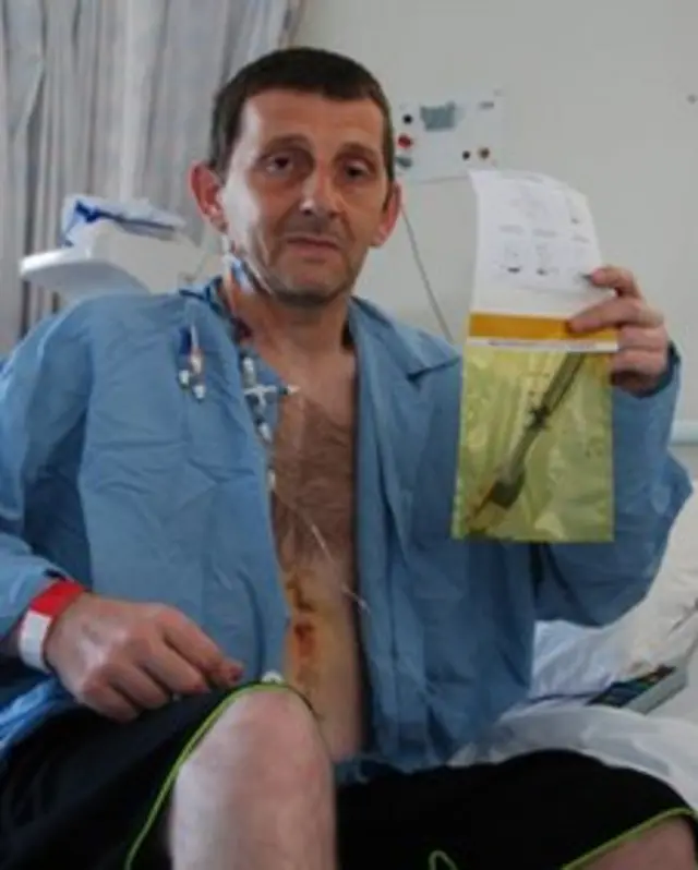 Lekari su njegov slučaj naknadno opisali i u naučnom časopisu