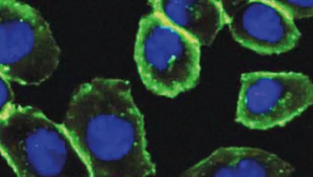 ผลงานของ ศ.เบอร์ทอซซี ทำให้สามารถติดตามทำแผนที่ของโมเลกุลน้ำตาล (เรืองแสงสีเขียว) ภายในเซลล์ได้