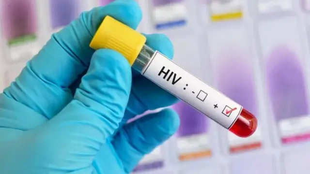 HIV