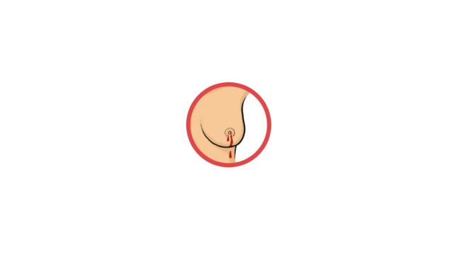 چھاتی کا کینسر