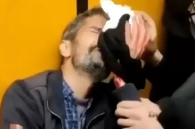 چشم پزشکان سه بیمارستان بزرگ تهران -فارابی، رسول‌ اکرم و لبافی‌نژاد - تخمین زدند که از زمان شروع اعتراضات در مجموع بیش از ۵۰۰ بیمار را پذیرش کرده‌اند که چشم‌هایشان به شدت آسیب دیده بود