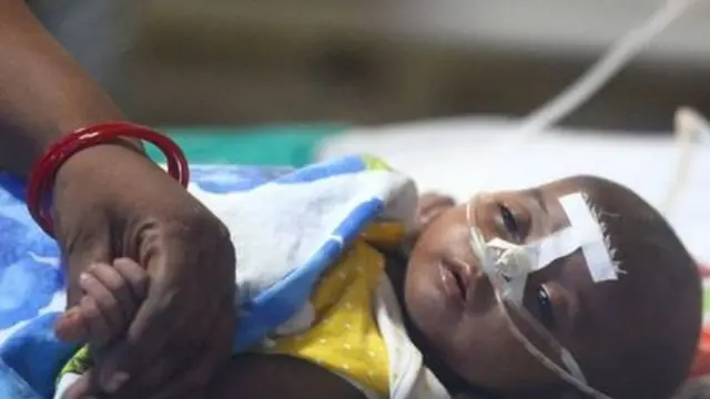 கோரக்பூரில் தொடரும் கொடுமை: 3 மாதங்களில் 1000 குழந்தைகள் மரணம்