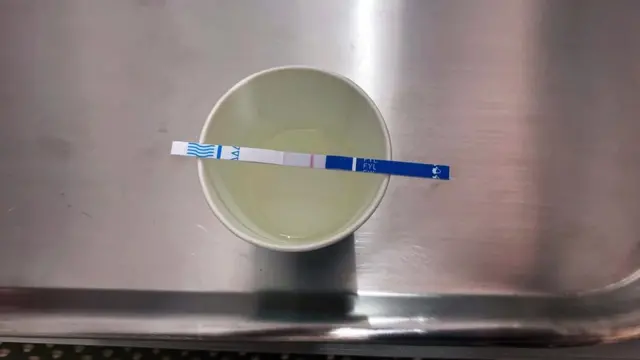 Resultado positivo en fentanilo