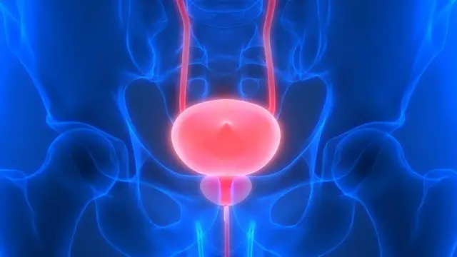 Piroosteetii qaamaa dhiiraa