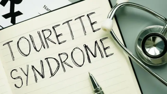 'தன்னிலை அறிதலே என்னை காப்பாற்றியது' – டூரெட்ஸ் குறைபாடு உள்ளவர்கள் அன்றாடம் சந்திக்கும் சவால்கள்