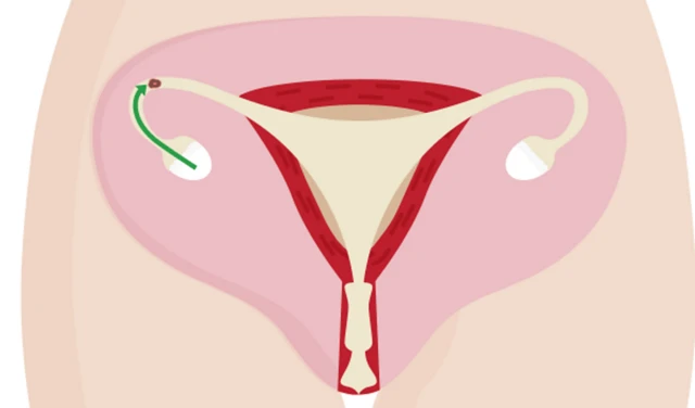 ስርዓተ ተዋልዶ ደቂ ኣንስትዮ