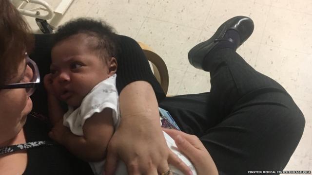 Bebê sendo acariciado