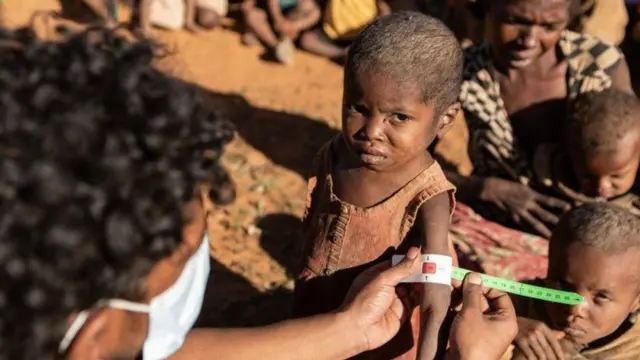 कुपोषण, भूकबळी