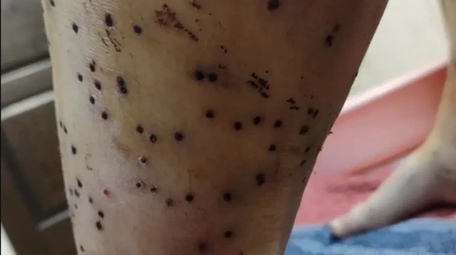 تصویر زخم ساچمه‌ها روی پای تارا که ده‌ها نقطه سیاه‌رنگ محل ورود ساچمه به بدن را نشان می‌دهد