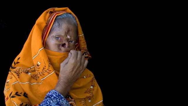 મહિલનો ફોટો