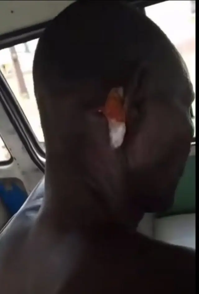 Ọkan lara awọn eeyan to farapa fi oju ọgbẹ rẹ han