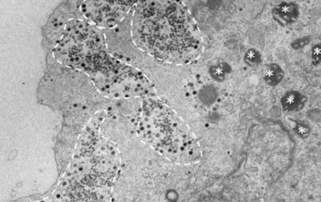 ไวรัสยารา (จุดเล็ก ๆ ภายในเส้นประ) ทำให้เกิดการติดเชื้อในอะมีบาได้