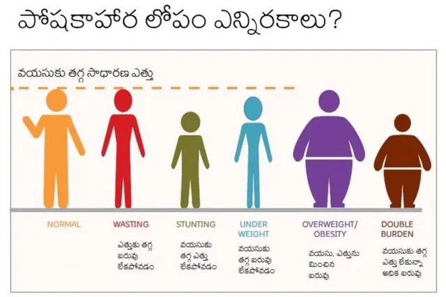 పోషకాహార లోపం