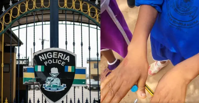 A na-ebo ebubo na akara 'Snake bite' bụ usoro nduba n'otu nzuzo n'akụkụ ụlọakwụkwọ ụfọdụ na Delta steeti.