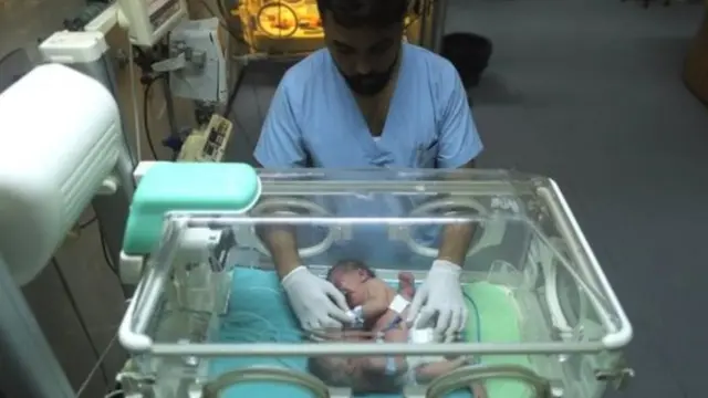 Awọn ibeji to lẹpọ ninu ibudo itọju pajawiri