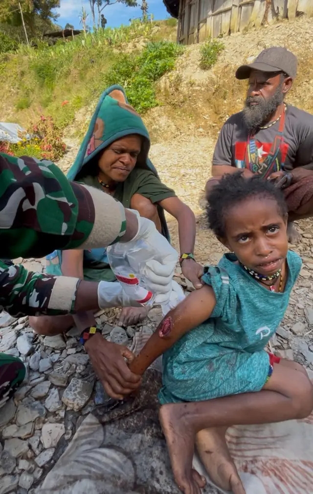 Kekerasan Papua