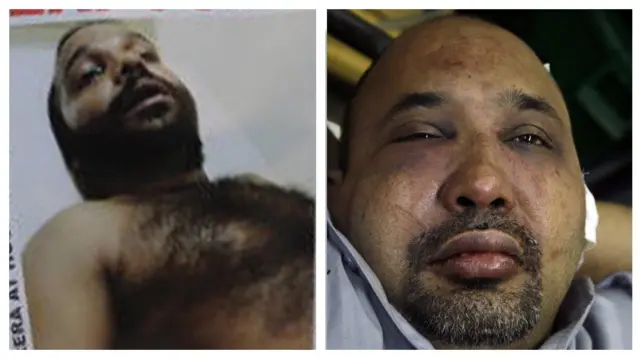 නාමල් පෙරේරා සහ කීත් නොයාර් පහරකෑමෙන් අනතුරුව