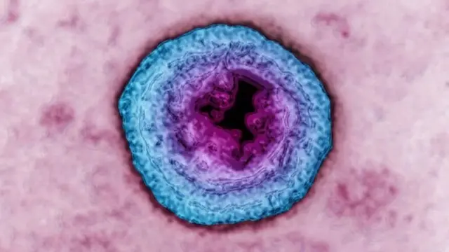 શરીરની રોગપ્રતિકારક શક્તિ ઓછી થાય ત્યારે વાઇરસ ફરીથી સક્રિય થઈ જાય છે