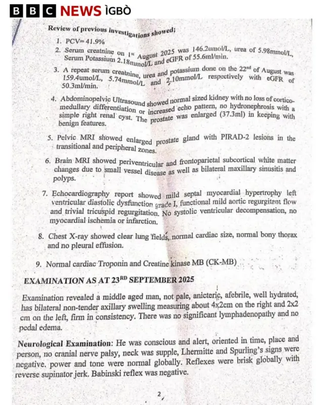 Mpụtara nyocha ụlọọrụ NMA mere banyere ahụike Nnamdi Kanu