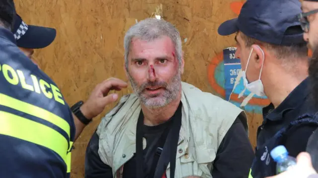 Пострадавший 5 июля 2021 года в центре Тбилиси журналист