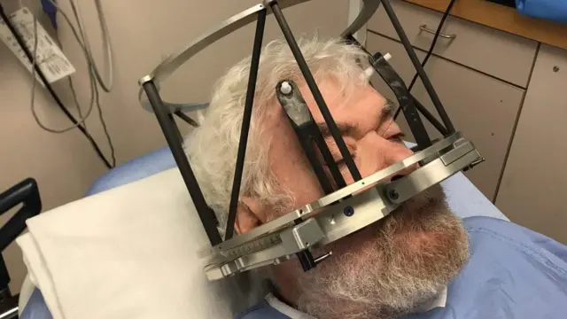 સર્જરી દરમિયાન ફ્રૅન્ક પ્લમર જાગૃત અવસ્થામાં હતા.